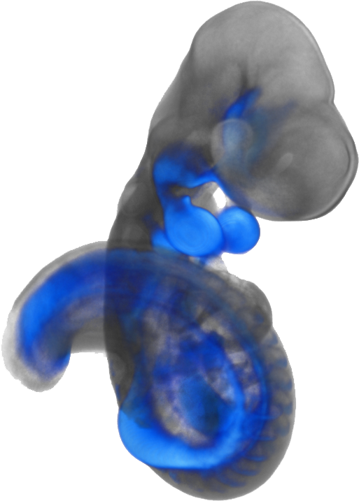 Gpc3