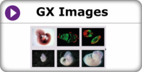 search for gene expression by image browse