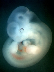 Theiler Stage 19 mouse embryo, fixed in 4% paraformaldehyde 