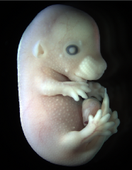 Theiler Stage 23 mouse embryo, fixed in bouins fixative 