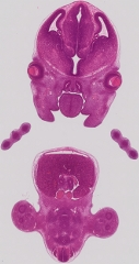 Theiler Stage 22 mouse embryo, frontal section stained with haematoxylin and eosin