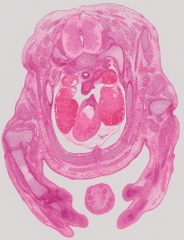 Theiler Stage 23 transverse section, stained with haematoxylin and eosin
