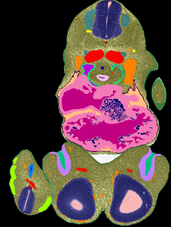 Delineated anatomy components on a transverse section from a Theiler Stage 19 mouse embryo