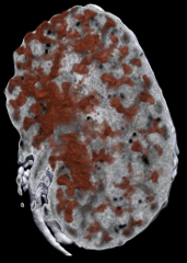 Theiler Stage 23 mouse kidney, expression of calbindin in ureteric tips 