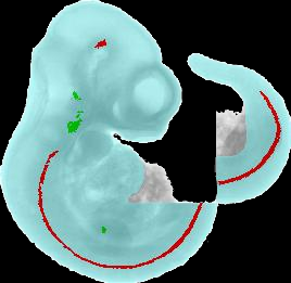 Mapped expression pattern of Lhx4 (EMAGE:1766) on Theiler Stage 17 model 