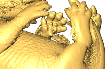 Theiler Stage 24 mouse embryo, close up of limb 