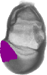 mouse atlas EMAGE spatial in situ gene expression database None