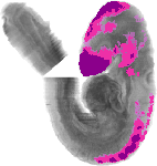 mouse atlas EMAGE spatial in situ gene expression database None
