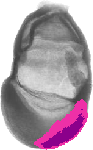 mouse atlas EMAGE spatial in situ gene expression database None