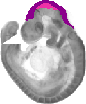 mouse atlas EMAGE spatial in situ gene expression database None