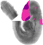mouse atlas EMAGE spatial in situ gene expression database None