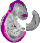 mouse atlas EMAGE spatial in situ gene expression database None