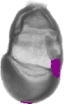 mouse atlas EMAGE spatial in situ gene expression database None