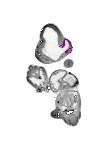 mouse atlas EMAGE spatial in situ gene expression database None