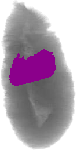 mouse atlas EMAGE spatial in situ gene expression database None