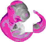 mouse atlas EMAGE spatial in situ gene expression database None