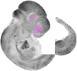 mouse atlas EMAGE spatial in situ gene expression database None