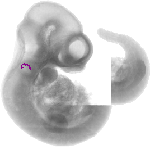 mouse atlas EMAGE spatial in situ gene expression database None