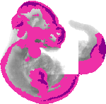 mouse atlas EMAGE spatial in situ gene expression database None