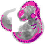 mouse atlas EMAGE spatial in situ gene expression database None