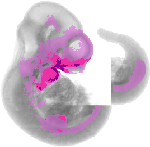 mouse atlas EMAGE spatial in situ gene expression database None
