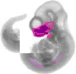 mouse atlas EMAGE spatial in situ gene expression database None