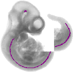 mouse atlas EMAGE spatial in situ gene expression database None