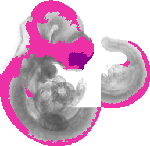 mouse atlas EMAGE spatial in situ gene expression database None