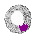 mouse atlas EMAGE spatial in situ gene expression database None