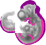 mouse atlas EMAGE spatial in situ gene expression database None