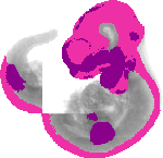 mouse atlas EMAGE spatial in situ gene expression database None