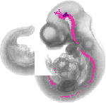 mouse atlas EMAGE spatial in situ gene expression database None