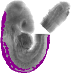 mouse atlas EMAGE spatial in situ gene expression database None