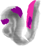 mouse atlas EMAGE spatial in situ gene expression database None