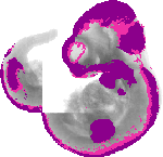 mouse atlas EMAGE spatial in situ gene expression database None