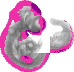 mouse atlas EMAGE spatial in situ gene expression database None