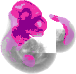 mouse atlas EMAGE spatial in situ gene expression database None