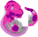 mouse atlas EMAGE spatial in situ gene expression database None