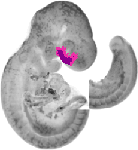 mouse atlas EMAGE spatial in situ gene expression database None