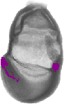 mouse atlas EMAGE spatial in situ gene expression database None