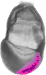 mouse atlas EMAGE spatial in situ gene expression database None