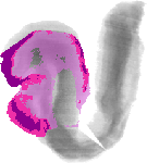 mouse atlas EMAGE spatial in situ gene expression database None