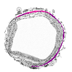 mouse atlas EMAGE spatial in situ gene expression database None
