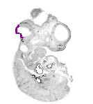 mouse atlas EMAGE spatial in situ gene expression database None