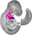 mouse atlas EMAGE spatial in situ gene expression database None