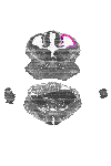 mouse atlas EMAGE spatial in situ gene expression database None