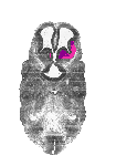 mouse atlas EMAGE spatial in situ gene expression database None