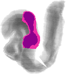 mouse atlas EMAGE spatial in situ gene expression database None