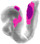 mouse atlas EMAGE spatial in situ gene expression database None