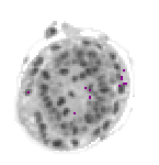 mouse atlas EMAGE spatial in situ gene expression database None